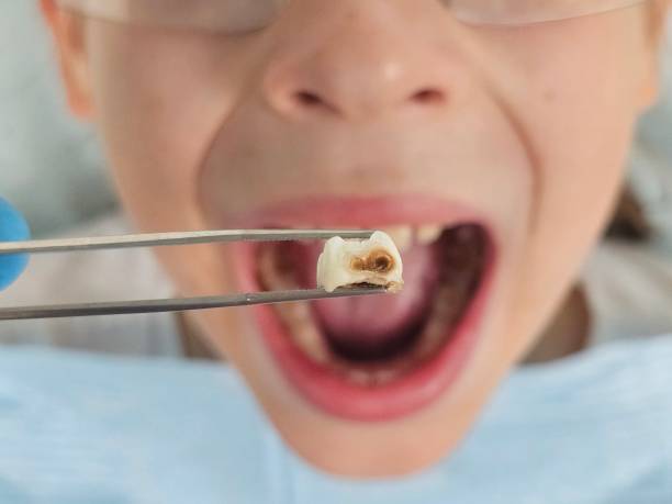 Best Weekend Emergency Dentist in Ness City, KS
