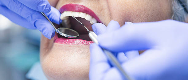 Best Emergency Dental Care for Broken or Chipped Teeth in Ness City, KS